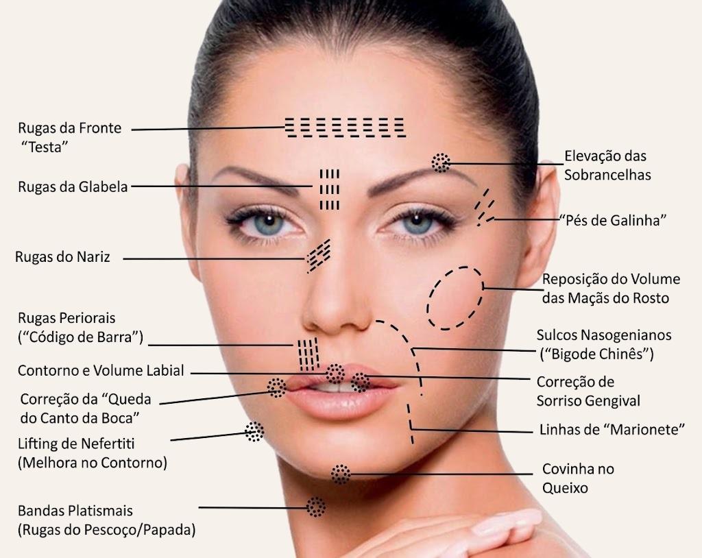 Mapa das áreas que o Full Face pode tratar: testa, glabela, sobrancelhas, pés de galinha, nariz, maçãs do rosto, bigode chinês, lábios, queixo, contorno e pescoço