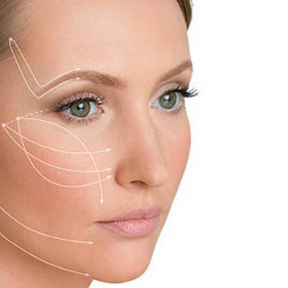 Procedimento Sculptra